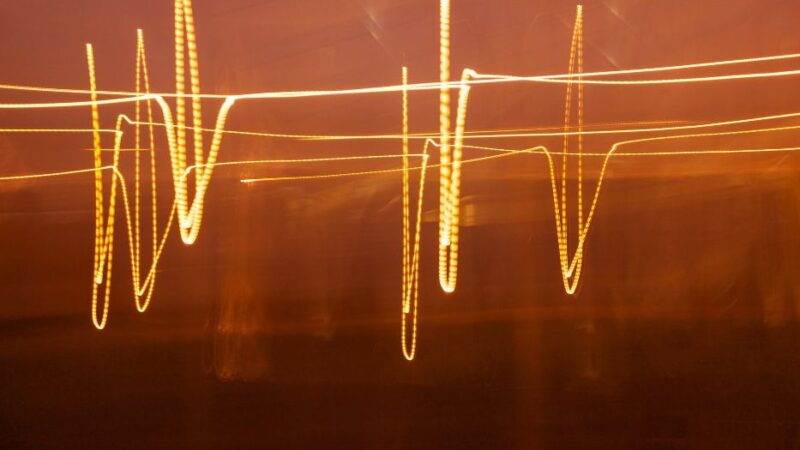 ultrasonic cavitation