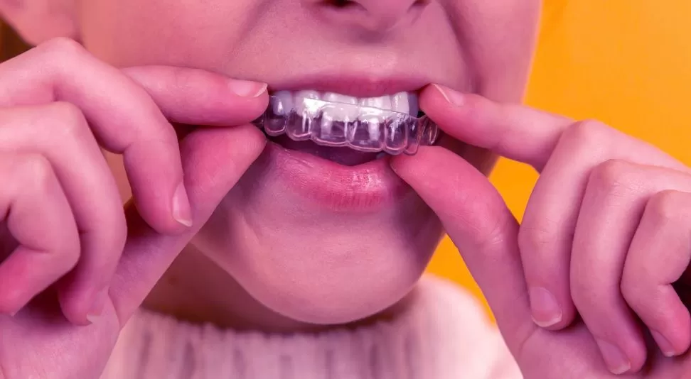 Unknown Facts About Emergency Dental