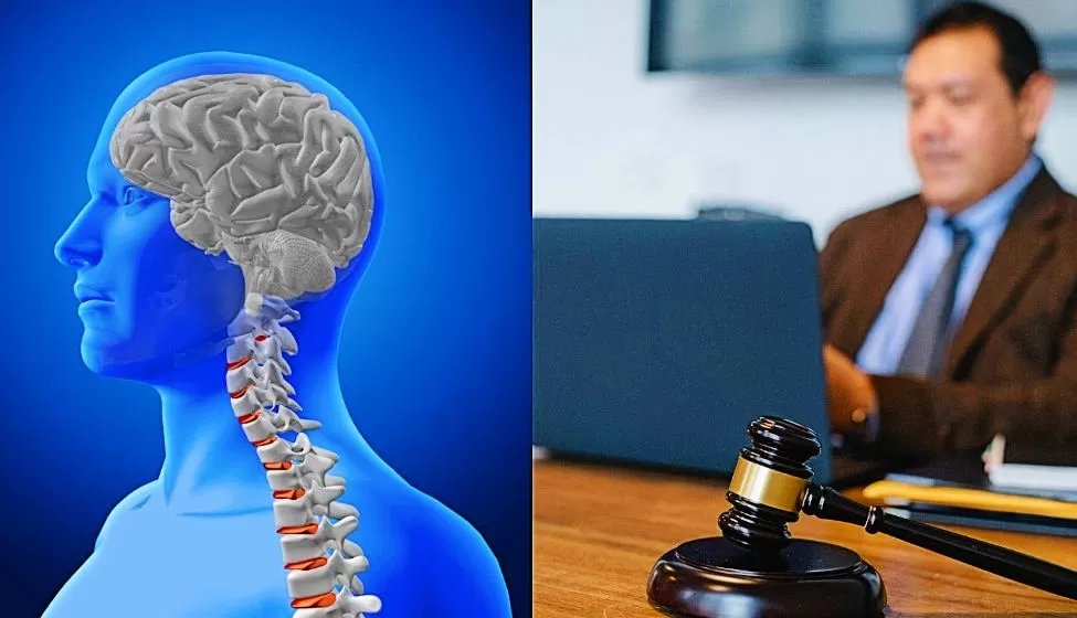 Top 6 Qualities to Consider When Hiring an Attorney for a Brain Injury Case
